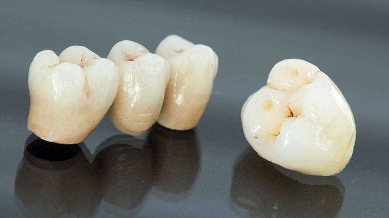Sứ không đạt chuẩn chất lượng Sứ không đạt chuẩn chất lượng